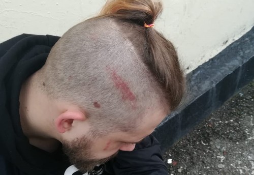 Полуян со шрамом на голове,23 января 2021 года. Фото Алексея Челмакина.
